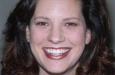 Cynthia's Porcelain Veneer Smile Makeover