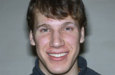 Tim's Smile Makeover