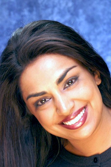 Shoba's Porcelain Veneer Smile Makeover