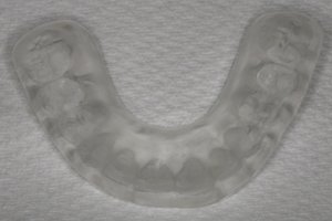 Photo of a night guard, available from New Jersey cosmetic dentist Dr. Allyson Hurley